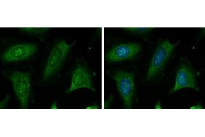 ICC/IF Image CBS antibody detects CBS protein at cytoplasm by immunofluorescent analysis.
