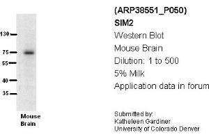 Image no. 1 for anti-Single-Minded Homolog 2 (SIM2) (N-Term) antibody (ABIN2780639) (SIM2 anticorps  (N-Term))