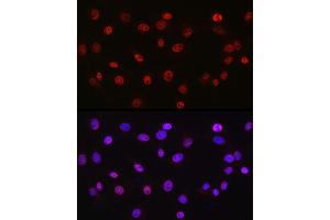Immunofluorescence analysis of NIH/3T3 cells using DDX39A antibody (ABIN6131590, ABIN6139489, ABIN6139491 and ABIN6223963) at dilution of 1:50.