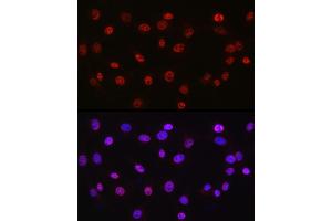 Immunofluorescence analysis of NIH/3T3 cells using DDX39A antibody (ABIN6131590, ABIN6139489, ABIN6139491 and ABIN6223963) at dilution of 1:50. (DDX39 anticorps  (AA 178-427))