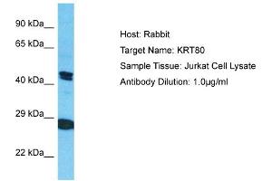 Host: Rabbit Target Name: KRT80 Sample Type: Jurkat Whole Cell lysates Antibody Dilution: 1. (KRT80 anticorps  (C-Term))