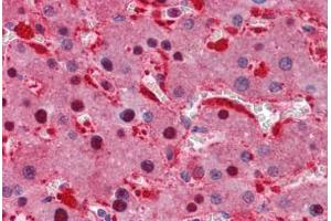 Human Liver: Formalin-Fixed, Paraffin-Embedded (FFPE) (IDH1 anticorps  (AA 30-307))
