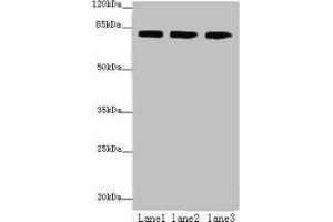 Western blot All lanes: AP4B1 antibody at 3 μg/mL Lane 1: HepG2 whole cell lysate Lane 2: U251 whole cell lysate Lane 3: LO2 whole cell lysate Secondary Goat polyclonal to rabbit IgG at 1/10000 dilution Predicted band size: 84, 35 kDa Observed band size: 84 kDa (AP4B1 anticorps  (AA 201-500))