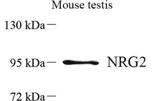 Western blot analysis of NRG2 (ABIN7074804) at dilution of 1: 500 (Neuregulin 2 anticorps)