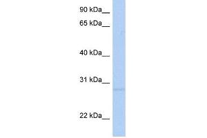 WB Suggested Anti-RNF41 Antibody Titration:  0.