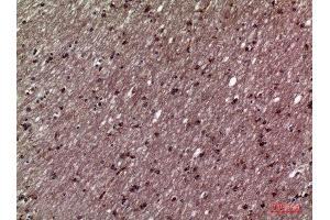 Immunohistochemistry (IHC) analysis of paraffin-embedded Human Brain, antibody was diluted at 1:100.