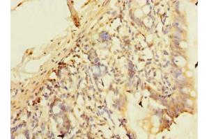 Immunohistochemistry of paraffin-embedded human small intestine tissue using ABIN7163662 at dilution of 1:100 (C10orf81 anticorps  (AA 181-462))