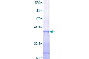 Image no. 1 for Ribonuclease L (2',5'-Oligoisoadenylate Synthetase-Dependent) (RNASEL) (AA 619-728) protein (GST tag) (ABIN1318166)