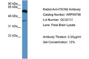 WB Suggested Anti-FSCN2  Antibody Titration: 0. (Fascin 2 anticorps  (Middle Region))