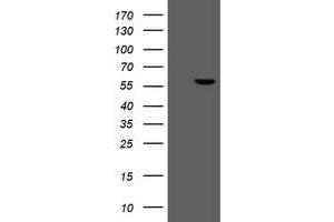 Western Blotting (WB) image for anti-Formiminotransferase Cyclodeaminase (FTCD) antibody (ABIN1496377) (FTCD anticorps)