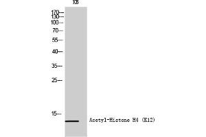 Western Blot analysis of KB cells using Acetyl-Histone H4 (K12) Polyclonal Antibody diluted at 1:500. (Histone H4 anticorps  (acLys12))