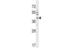 NKX6. (NKX6-1 anticorps  (AA 285-314))