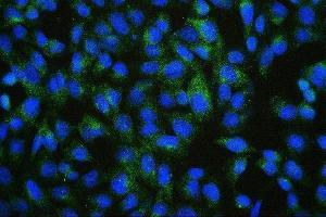 IF analysis of PDCD6IP using anti-PDCD6IP antibody (ABIN7600490). (ALIX anticorps  (AA 2-330))