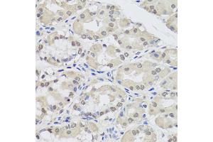 Immunohistochemistry of paraffin-embedded human stomach using AGO2 antibody (ABIN5974124) at dilution of 1/100 (40x lens). (AGO2 anticorps)