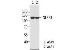 Western Blotting (WB) image for anti-NLR Family, Pyrin Domain Containing 2 (NLRP2) antibody (ABIN2666255) (NLRP2 anticorps)