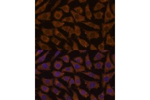 Immunofluorescence analysis of L929 cells using MTMR4 Polyclonal Antibody (ABIN7268764) at dilution of 1:100 (40x lens). (MTMR4 anticorps  (AA 920-1195))