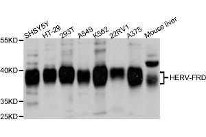 Western blot analysis of extracts of various cell lines, using ERVFRD-1 antibody (ABIN4903610) at 1:1000 dilution. (HERV-FRD Provirus Ancestral Env Polyprotein (Herv-frd) anticorps)