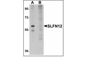 Western blot analysis of SLFN12 in SK-N-SH cell lysate with SLFN12 antibody at 1 µg/ml in (A) the absence and (B) the presence of blocking peptide. (SLFN12 anticorps  (C-Term))
