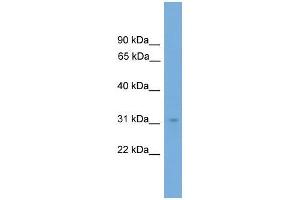 Human COLO205; WB Suggested Anti-NRBF2 Antibody Titration: 0. (NRBF2 anticorps  (N-Term))