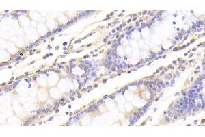 Detection of CASP7 in Human Colon Tissue using Polyclonal Antibody to Caspase 7 (CASP7)