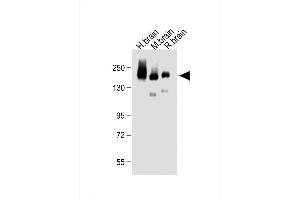 All lanes : Anti-NC Antibody (C-term) at 1:500 dilution Lane 1: Human brain lysate Lane 2: Mouse brain lysate Lane 3: Rat brain lysate Lysates/proteins at 20 μg per lane. (CD56 anticorps  (C-Term))