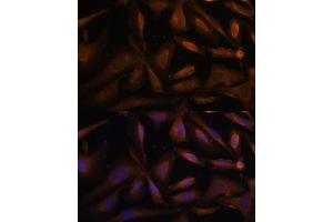 Immunofluorescence analysis of U-2 OS cells using UFC1 Polyclonal Antibody (ABIN6130770, ABIN6149886, ABIN6149887 and ABIN6217098) at dilution of 1:100 (40x lens). (UFC1 anticorps  (AA 1-167))