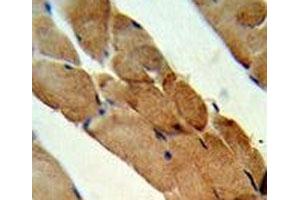 IHC analysis of FFPE human skeletal muscle stained with RANKL antibody (RANKL anticorps  (AA 1-30))