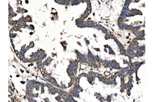 IHC analysis of PICALM using anti-PICALM antibody (ABIN7599516). (PICALM anticorps  (AA 1-652))