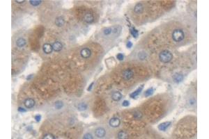 Detection of KRT33A in Human Liver Tissue using Polyclonal Antibody to Keratin 33A (KRT33A)