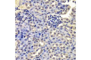 Immunohistochemistry of paraffin-embedded Mouse kidney using LSM4 antibody at dilution of 1:100 (x400 lens).