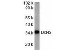 Western Blotting (WB) image for anti-Tumor Necrosis Factor Receptor Superfamily, Member 10d, Decoy with Truncated Death Domain (TNFRSF10D) (AA 249-263) antibody (ABIN2479560) (DcR2 anticorps  (AA 249-263))