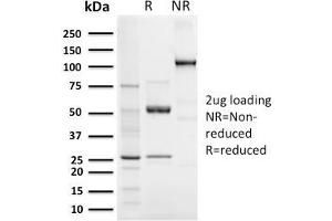 SDS-PAGE Analysis Purified Elastin Recombinant Rabbit Monoclonal Antibody (ELN/3131R). (Recombinant Elastin anticorps)
