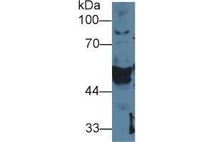 anti-Keratin 14 (KRT14) (AA 1-484) antibody