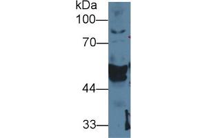 Detection of CK14 in Cavia Salivary gland lysate using Polyclonal Antibody to Cytokeratin 14 (CK14) (KRT14 anticorps  (AA 1-484))