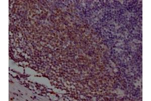 IHC image of ABIN7127370 diluted at 1:100 and staining in paraffin-embedded human appendix tissue performed on a Leica BondTM system. (Recombinant POU2AF1 anticorps)