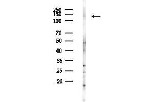 anti-Structural Maintenance of Chromosomes 5 (SMC5) (C-Term) antibody
