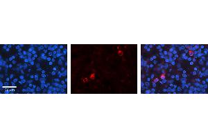 Rabbit Anti-KEAP1 Antibody   Formalin Fixed Paraffin Embedded Tissue: Human Lymph Node Tissue Observed Staining: Cytoplasm, Nucleus Primary Antibody Concentration: 1:100 Other Working Concentrations: N/A Secondary Antibody: Donkey anti-Rabbit-Cy3 Secondary Antibody Concentration: 1:200 Magnification: 20X Exposure Time: 0. (KEAP1 anticorps  (N-Term))