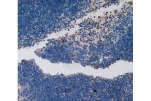 Used in DAB staining on fromalin fixed paraffin- embedded spleen tissue