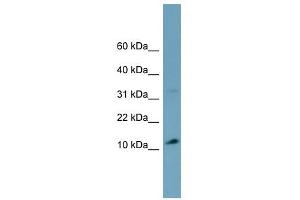 TRIM36 antibody used at 1 ug/ml to detect target protein. (TRIM36 anticorps  (Middle Region))