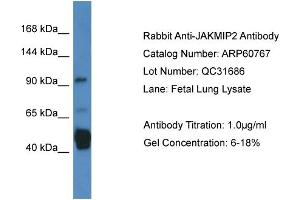 Western Blotting (WB) image for anti-Janus Kinase and Microtubule Interacting Protein 2 (JAKMIP2) (C-Term) antibody (ABIN2788569) (JAKMIP2 anticorps  (C-Term))