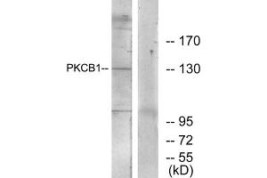 Western blot analysis of extracts from 293 cells, using PKCB1 antibody.