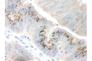 Image no. 2 for anti-Growth Regulated Oncogene gamma (GRO gamma) antibody (ABIN465908) (GRO gamma anticorps)