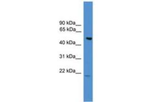 Image no. 1 for anti-Amyotrophic Lateral Sclerosis 2 (Juvenile) Chromosome Region, Candidate 12 (ALS2CR12) (AA 110-159) antibody (ABIN6745420) (ALS2CR12 anticorps  (AA 110-159))