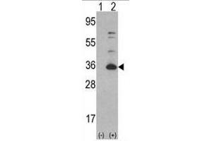 Western blot analysis of CDK4 (arrow) using rabbit polyclonal CDK4 Antibody (C-term) (ABIN391751 and ABIN2841625).
