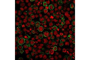 Immunofluorescence staining of MOLT-4 cells using CD20 Monoclonal Antibody (SPM494) followed by goat anti-Mouse IgG conjugated to CF488 (green). (CD20 anticorps)