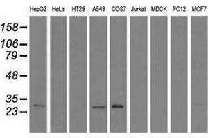 Western blot analysis of extracts (35 µg) from 9 different cell lines by using anti-SPR monoclonal antibody. (SPR anticorps)