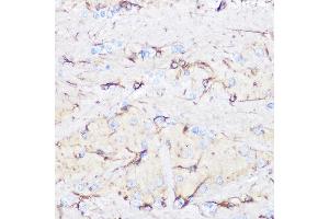 Immunohistochemistry of paraffin-embedded rat brain using GFAP Rabbit pAb (ABIN3020750, ABIN3020751, ABIN3020752, ABIN1512943 and ABIN6213705) at dilution of 1:100 (40x lens).