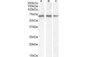 (ABIN185483) (2 μg/mL) staining of A431 (A), HEK293 (B) and (1 μg/mL) HepG2 (C) cell lysate (35 μg protein in RIPA buffer).