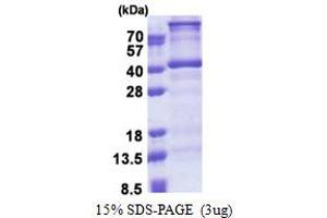 SDS-PAGE (SDS) image for Deoxynucleotidyltransferase, Terminal, Interacting Protein 1 (DNTTIP1) (AA 1-329) protein (His tag) (ABIN5853253) (DNTTIP1 Protein (AA 1-329) (His tag))