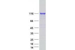 Validation with Western Blot